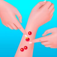 Игра Давить прыщи